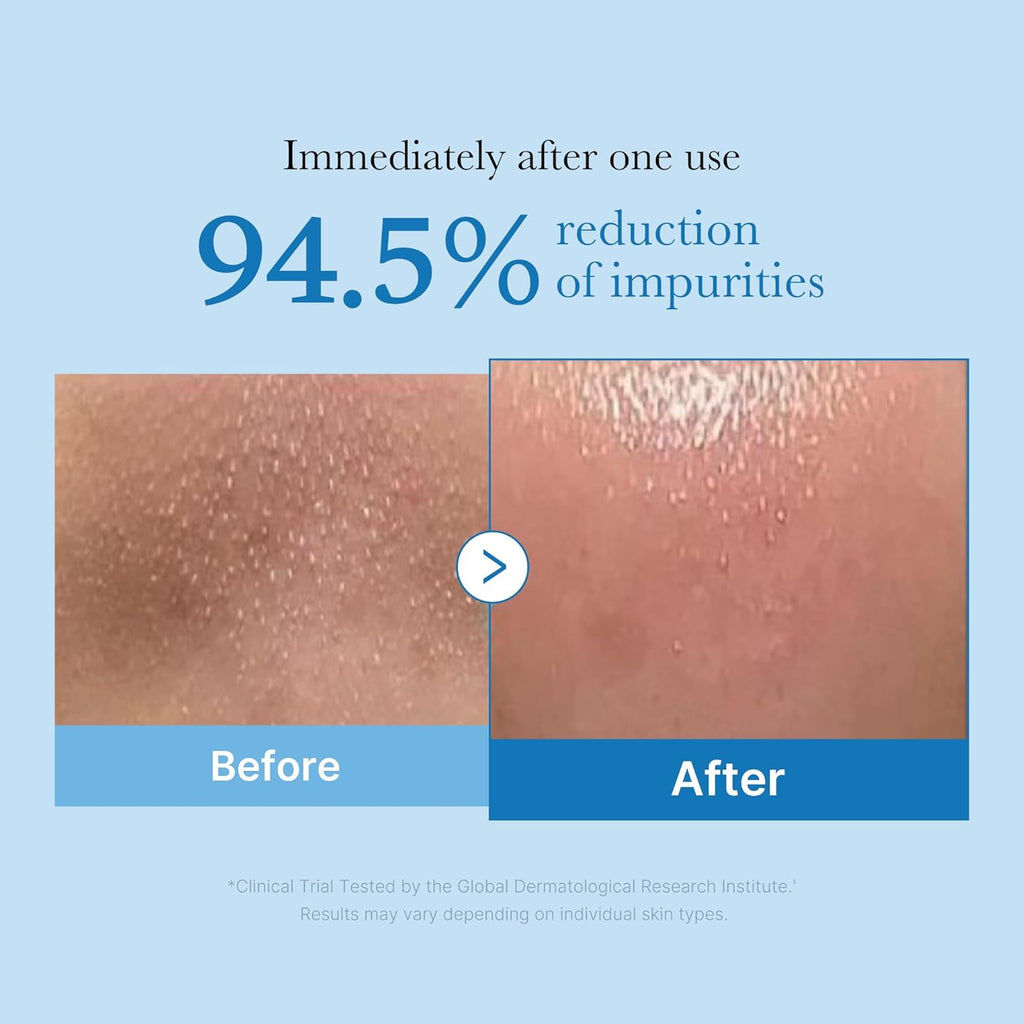 Medicube Zero Pore Blackhead Cleansing Oil – Makeup Remover & Deep Cleansing Oil | Blackhead Care, Pore Purifying & Low-Irritation Formula | Korean Skincare | 205ml (6.93 fl.oz)