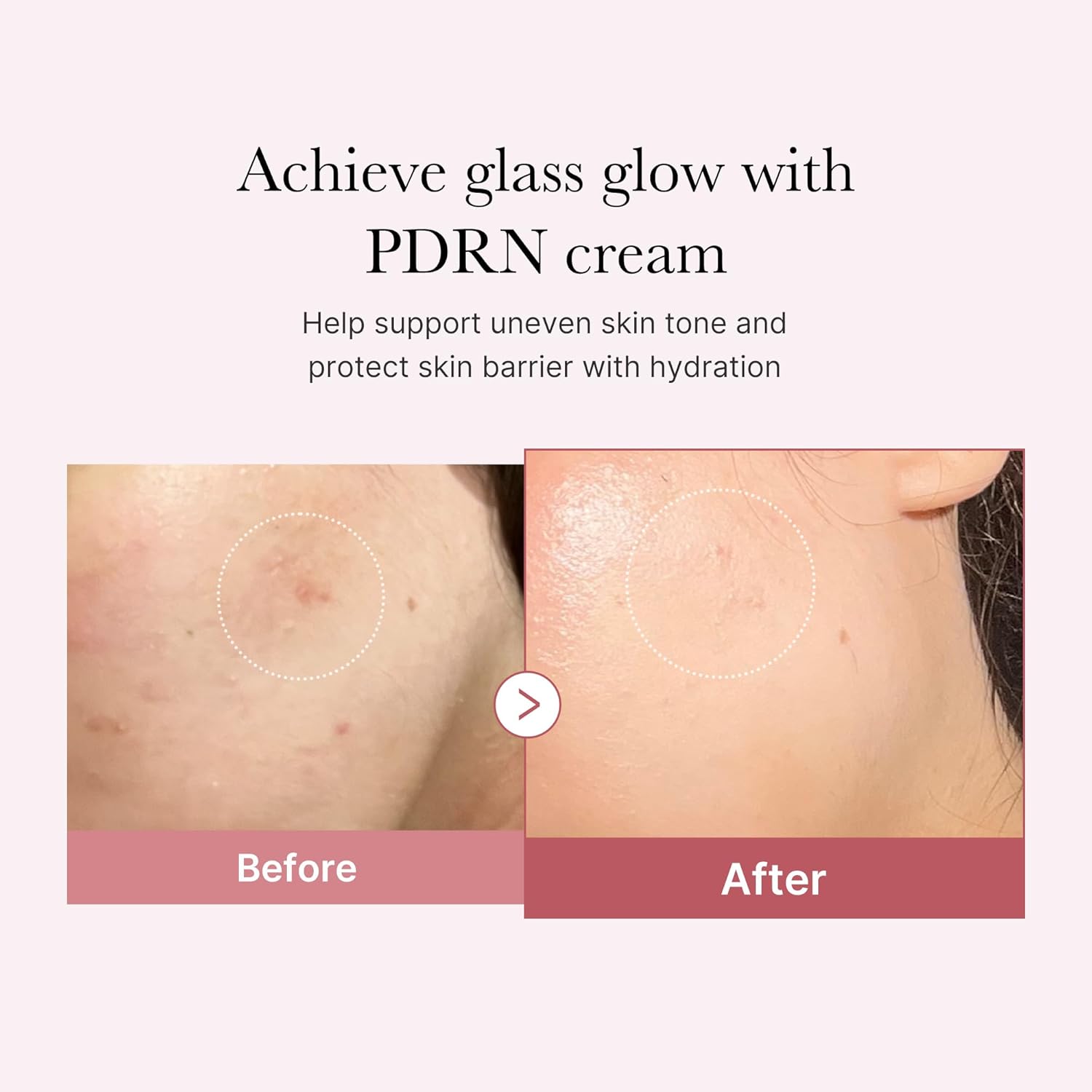 Medicube Salmon DNA PDRN Pink Hyaluronic Moisturizing Cream – Hydrating & Blemish Relief Cream | Restores Elasticity, Glow, Even Skin Tone & Pore Care | Korean Skincare | 50ml / 1.69 fl.oz