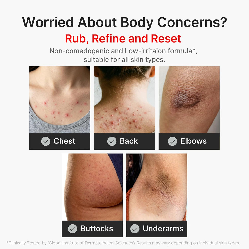 Medicube Body Peel Shot – Gentle Body Brightening & Exfoliating Serum | Kojic Acid & Turmeric + BHA, LHA & PHA for Dead Skin Removal, Uneven Tone & Excess Sebum | Korean Skincare | 9.46 fl.oz