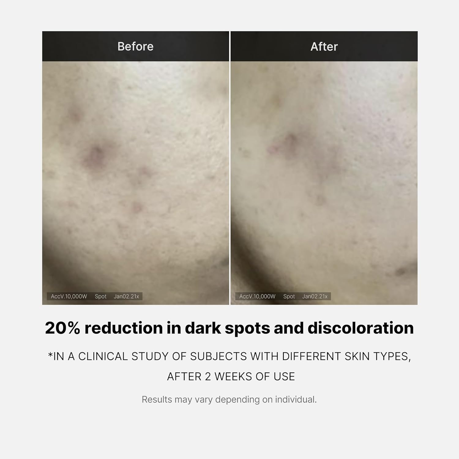 Medicube Deep Vita C Serum 2.0 – 14.5% Pure Vitamin C Brightening Serum | Reduces Hyperpigmentation, Dark Spots & Blemishes | Korean Skincare | 10g × 3 Bottles